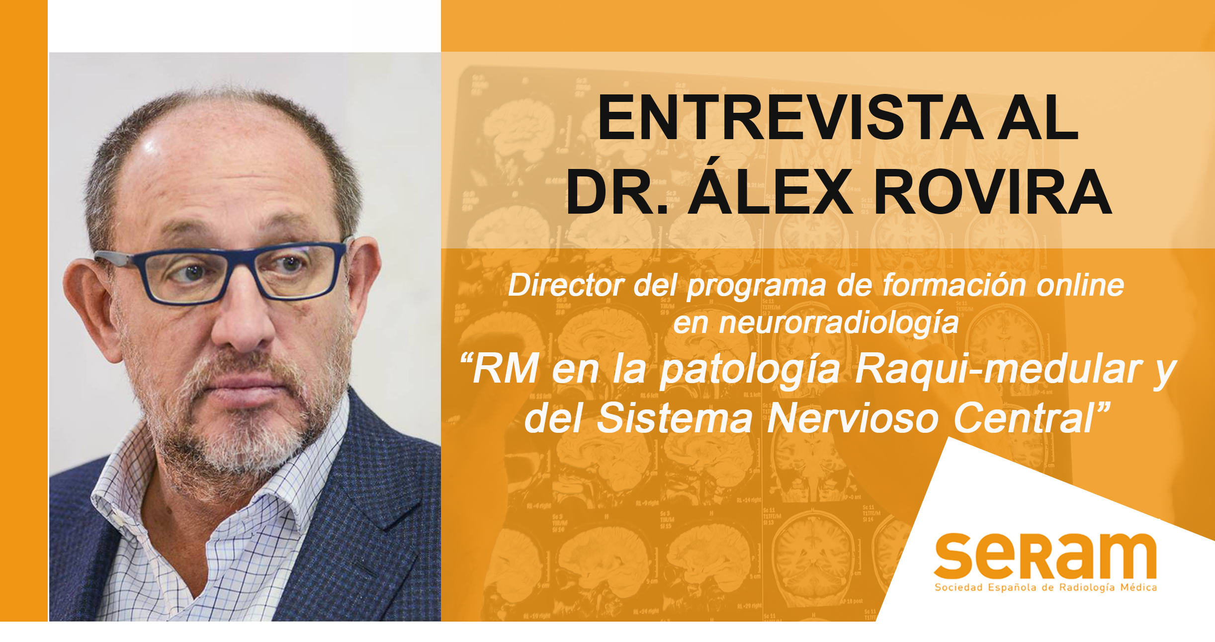 Entrevista al Dr. Álex Rovira, director del programa de formación SERAM en neurorradiología - SERAM