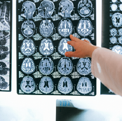 Pack Neuorradiología