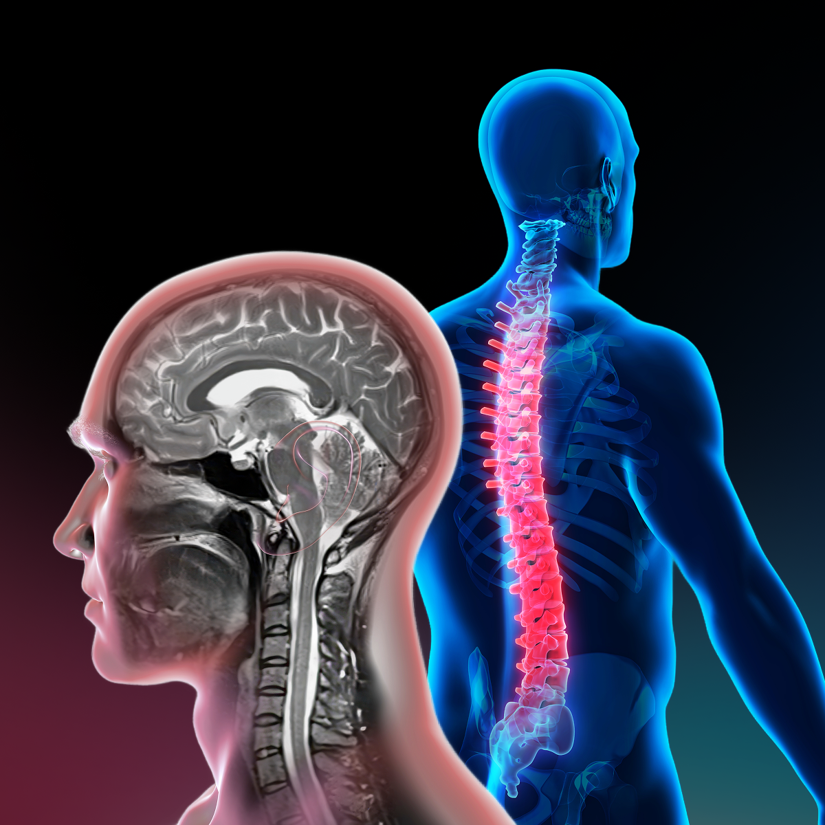 Cursos SERAM / SENR de Resonancia Magnética en Neurorradiología 2026