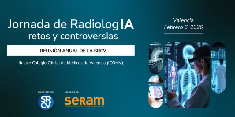 banner SRCV_1200x600px_aval SERAM