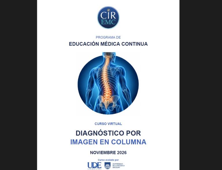 CIR Columna