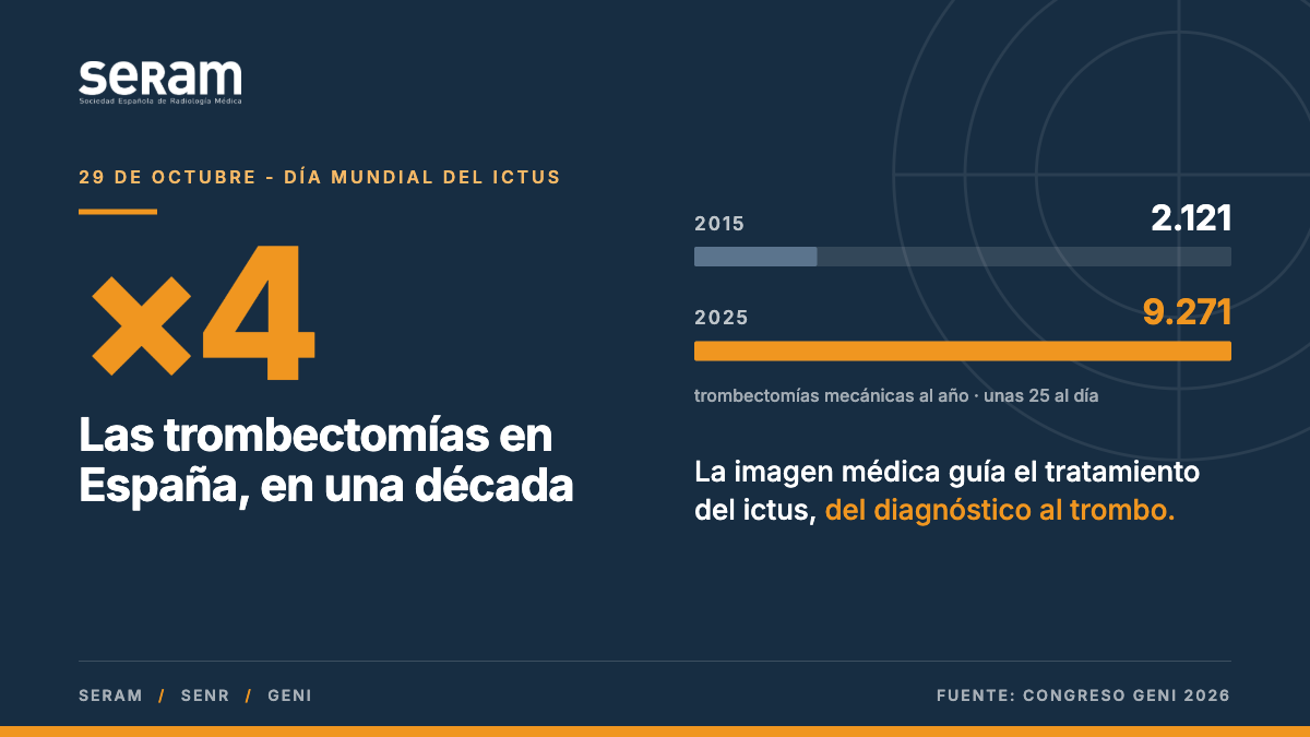 España multiplica por cuatro en una década las trombectomías para tratar el ictus, según especialistas de SERAM, SENR y GeNI